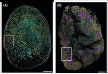 Immune cell discovery could lead to improved chronic worm treatment