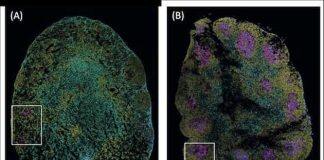 Immune cell discovery could lead to improved chronic worm treatment