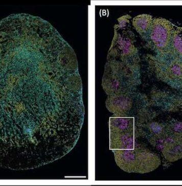 Immune cell discovery could lead to improved chronic worm treatment