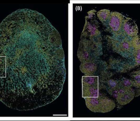 Immune cell discovery could lead to improved chronic worm treatment