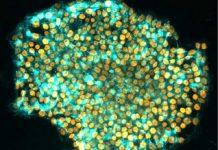Scientists find way to wipe a cell’s memory to better reprogram it as a stem cell