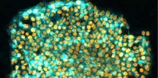 Scientists find way to wipe a cell’s memory to better reprogram it as a stem cell