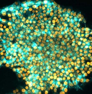 Scientists find way to wipe a cell’s memory to better reprogram it as a stem cell