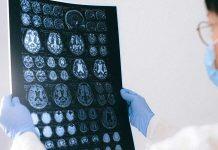 Heriot-Watt laser experts support project to tackle deadly brain tumours