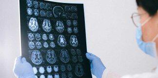 Heriot-Watt laser experts support project to tackle deadly brain tumours