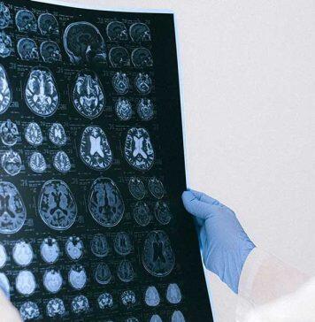 Heriot-Watt laser experts support project to tackle deadly brain tumours