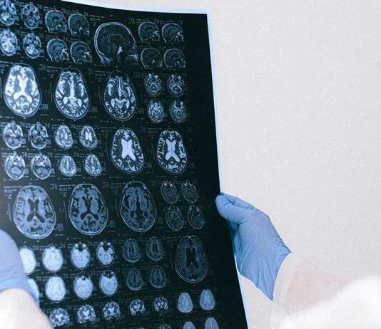 Heriot-Watt laser experts support project to tackle deadly brain tumours