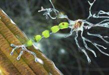 New research institute to accelerate the search for a cure for MND