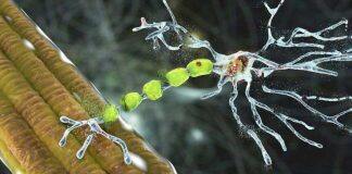 New research institute to accelerate the search for a cure for MND