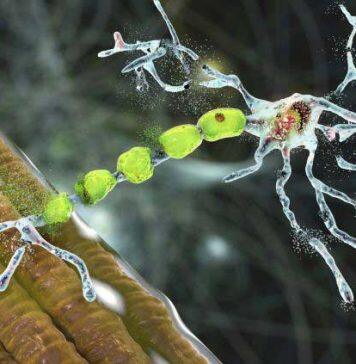 New research institute to accelerate the search for a cure for MND