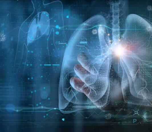 New research sets to improve detection of high blood pressure in the lungs using advanced imaging tools