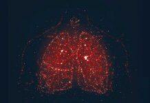 Supporting lung health with break-through monitoring technology