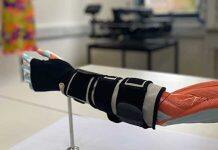 A smart glove to improve stroke rehabilitation