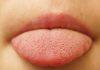 AI study reveals tongue’s unique surface