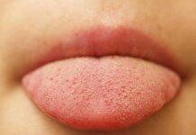 AI study reveals tongue’s unique surface