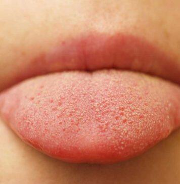 AI study reveals tongue’s unique surface