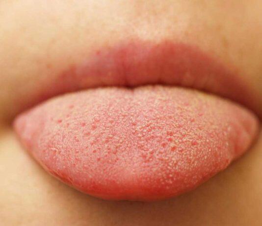 AI study reveals tongue’s unique surface