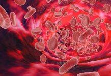 UWA study offers free iron deficiency screenings for women in Karrinyup