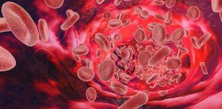 UWA study offers free iron deficiency screenings for women in Karrinyup