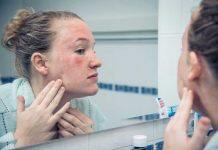 People with eczema needed to help with bathing study