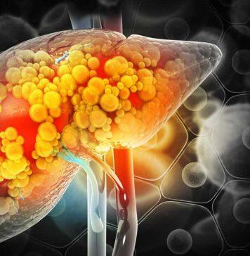 Global study to spur new liver cirrhosis medicines