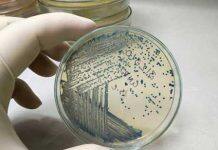 Revealing what makes bacteria life-threatening
