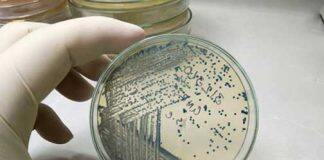 Revealing what makes bacteria life-threatening