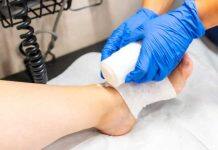 Revolutionary chronic wound treatment could help millions