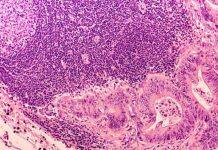 Dr Andrew Davidson awarded prestigious Academy of Medical Sciences Springboard funding