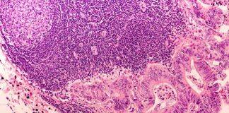 Dr Andrew Davidson awarded prestigious Academy of Medical Sciences Springboard funding