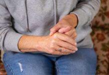 Participants needed for study of promising drug for hand osteoarthritis
