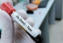 Obese and overweight children at risk of iron deficiency