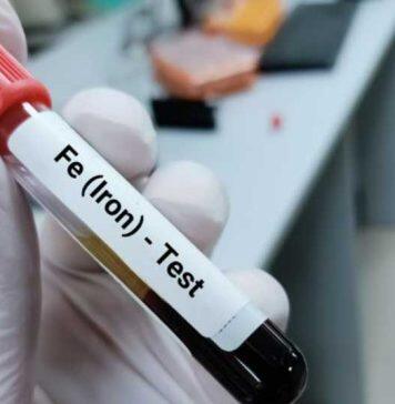 Obese and overweight children at risk of iron deficiency