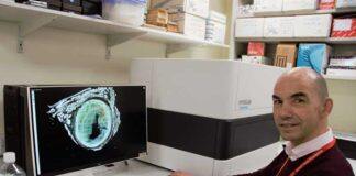 Novel Bristol therapeutic to target atheroschlerosis