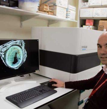 Novel Bristol therapeutic to target atheroschlerosis