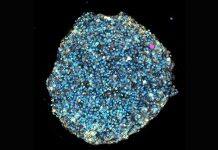 ‘Squishy’ lasers could reveal how tumours and babies grow