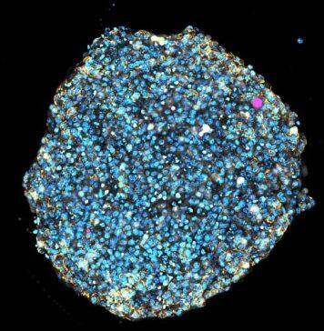 ‘Squishy’ lasers could reveal how tumours and babies grow