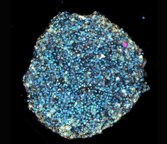 ‘Squishy’ lasers could reveal how tumours and babies grow