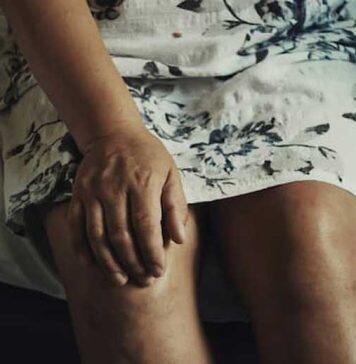 Repurposed diabetes drug can reduce pain for those with knee arthritis and overweight or obesity: study