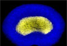 Scientists take stand against back pain unveiling functional bioprinted spinal discs