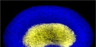 Scientists take stand against back pain unveiling functional bioprinted spinal discs