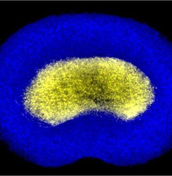 Scientists take stand against back pain unveiling functional bioprinted spinal discs