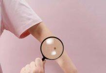 Giving doctors an AI-powered head start on skin cancer