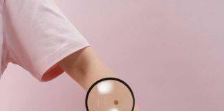 Giving doctors an AI-powered head start on skin cancer