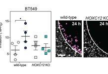 New study uncovers how beta blockers could halt the progression of triple negative breast cancer