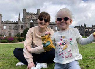 Hope for young children with impaired eye sight caused by Albinism