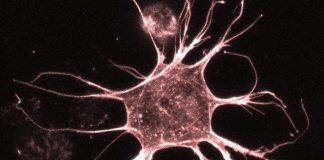 Zooming in: UQ photo contest captures science at the nanoscale