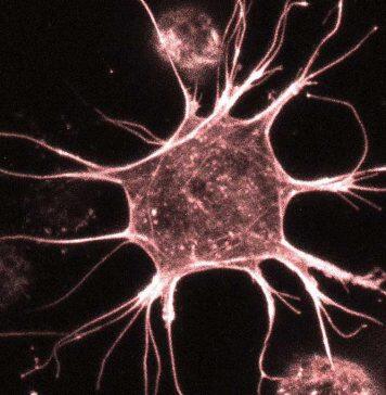 Zooming in: UQ photo contest captures science at the nanoscale