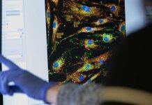 New drug candidate offers hope to slow down MND progress