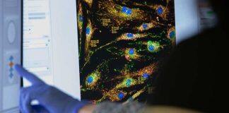 New drug candidate offers hope to slow down MND progress